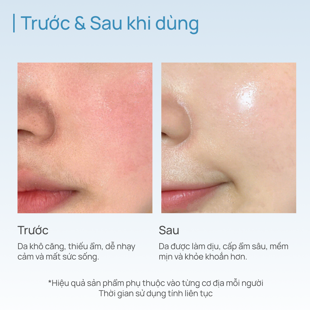 Combo 03 Mặt Nạ Thảo Dược Dưỡng Ẩm, Sáng Da, Thu Nhỏ Lỗ Chân Lông CHANDO (15 MIẾNG)