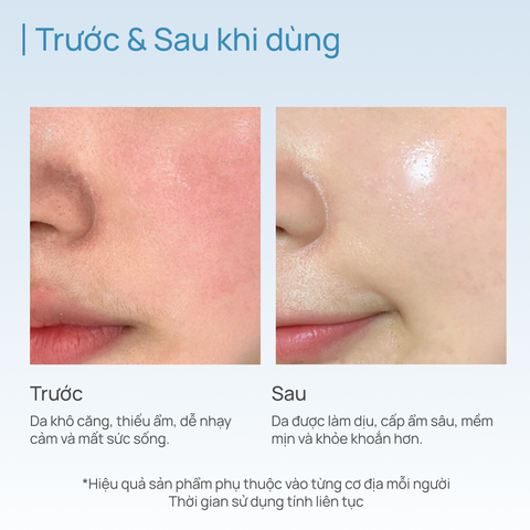 Combo 03 Mặt Nạ Thảo Dược Dưỡng Ẩm, Sáng Da, Thu Nhỏ Lỗ Chân Lông CHANDO (15 MIẾNG)