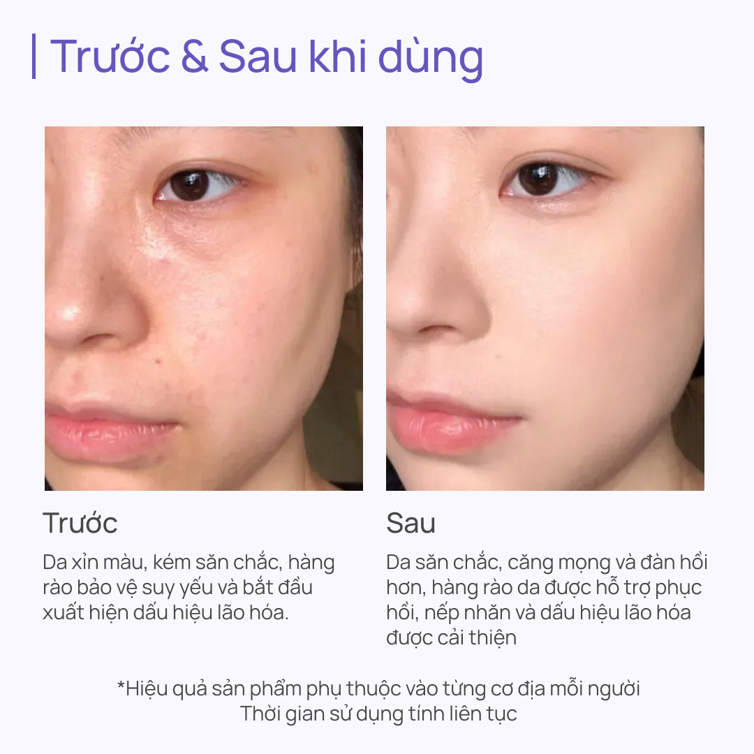Tinh Chất Mờ Nhăn, Tái Tạo Da, Dưỡng Sáng Toàn Năng CHANDO New Time Frozen Essence 35ml