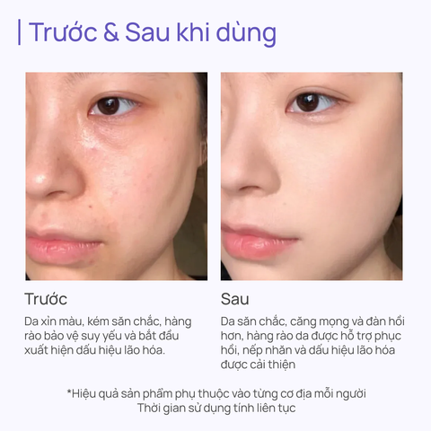 Tinh Chất Mờ Nhăn, Tái Tạo Da, Dưỡng Sáng Toàn Năng CHANDO New Time Frozen Essence 35ml