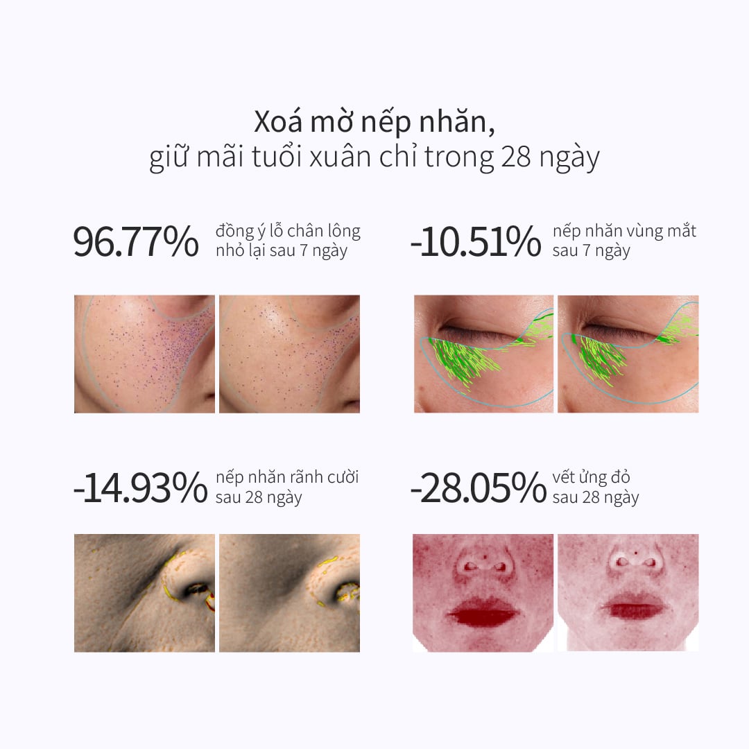 Kem Dưỡng Giúp Phục Hồi Da Lão Hóa Toàn Năng CHANDO Himalaya 55g Hàng Chính Hãng