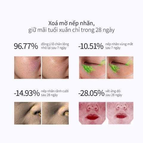 Kem Dưỡng Giúp Phục Hồi Da Lão Hóa Toàn Năng CHANDO Himalaya 55g Hàng Chính Hãng