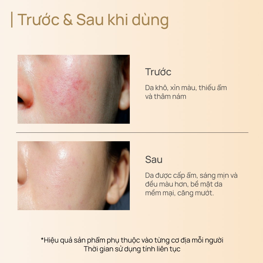 Toner Dưỡng Trắng, Làm Sáng & Chống Lão Hóa CHANDO CellCrystal Whitening Radiance Rejuvenating 150ml
