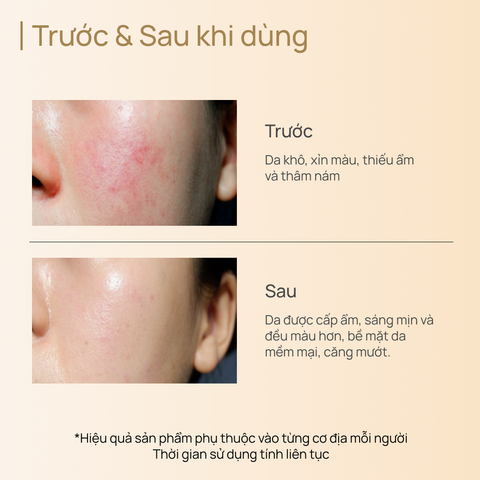 Toner Dưỡng Trắng, Làm Sáng & Chống Lão Hóa CHANDO CellCrystal Whitening Radiance Rejuvenating 150ml