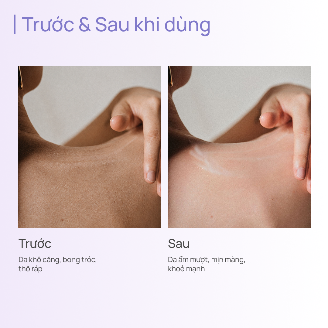 Sữa Dưỡng Thể Hỗ Trợ Dưỡng Ẩm 600g CHANDO Himalaya Hàng Chính Hãng