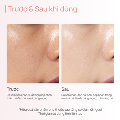 Tinh Chất Chống Lão Hóa, Làm Sáng & Săn Chắc Da CHANDO Pink Diamond Firming Delicate Rose Essence 45ml
