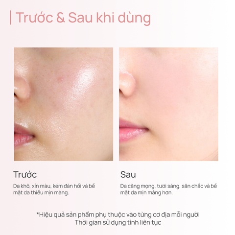 Toner Hỗ Trợ Cải Thiện Độ Đàn Hồi Cho Da Kém Săn Chắc CHANDO Himalaya 110ml Hàng Chính Hãng