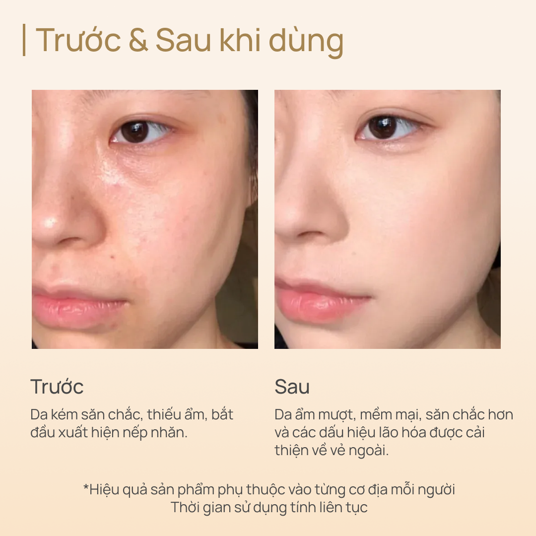 Tinh Chất Tăng Sinh Collagen, Phục Hồi Tổn Thương và Chống Lão Hoá CHANDO Extra Collagen 50ml