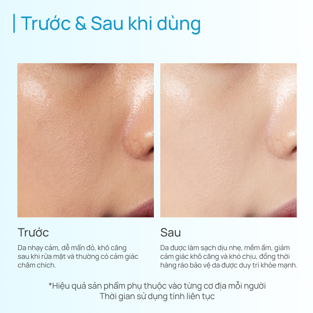 Sữa Rửa Mặt Làm Dịu & Cấp Ẩm CHANDO Soothing Moisturizing Amino Acid 150ml