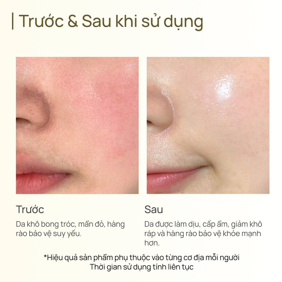 Mặt Nạ Phục Hồi CHANDO Ferment Ampoule Mask 5 MIẾNG