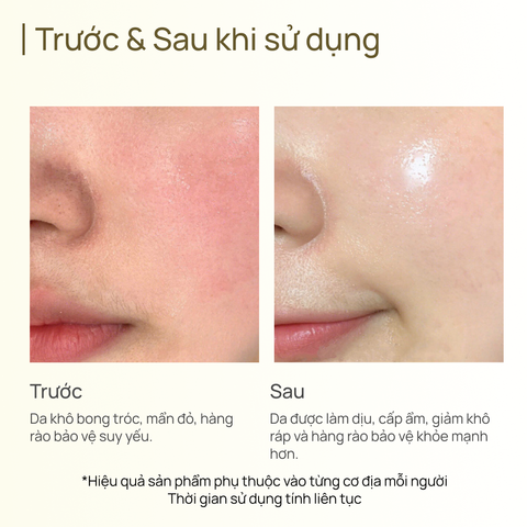 Mặt Nạ Phục Hồi CHANDO Ferment Ampoule Mask 5 MIẾNG