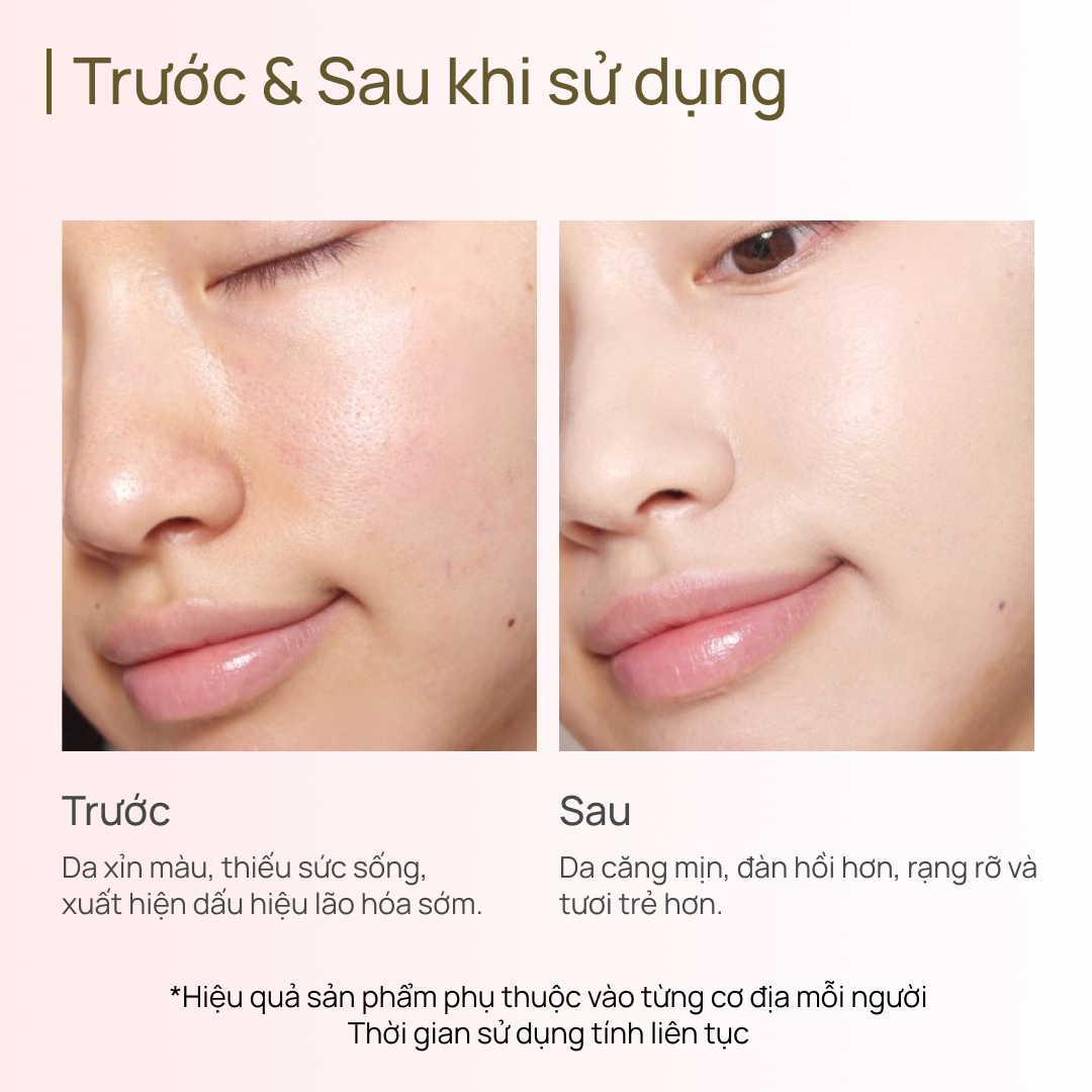Mặt Nạ Chống Oxy Hóa CHANDO Astaxanthin Ampoule Mask 5 MIẾNG