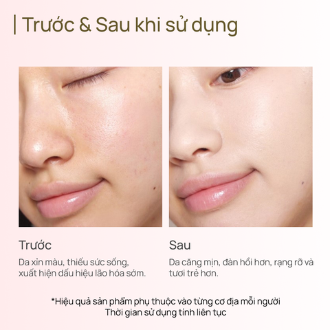 Mặt Nạ Chống Oxy Hóa CHANDO Astaxanthin Ampoule Mask 5 MIẾNG
