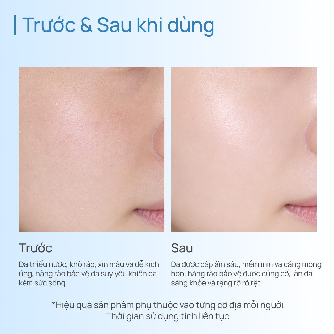 Tinh Chất Dưỡng Ẩm & Phục Hồi CHANDO Snowy Region Essence 40ml