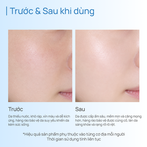 Tinh Chất Dưỡng Ẩm & Phục Hồi CHANDO Snowy Region Essence 40ml