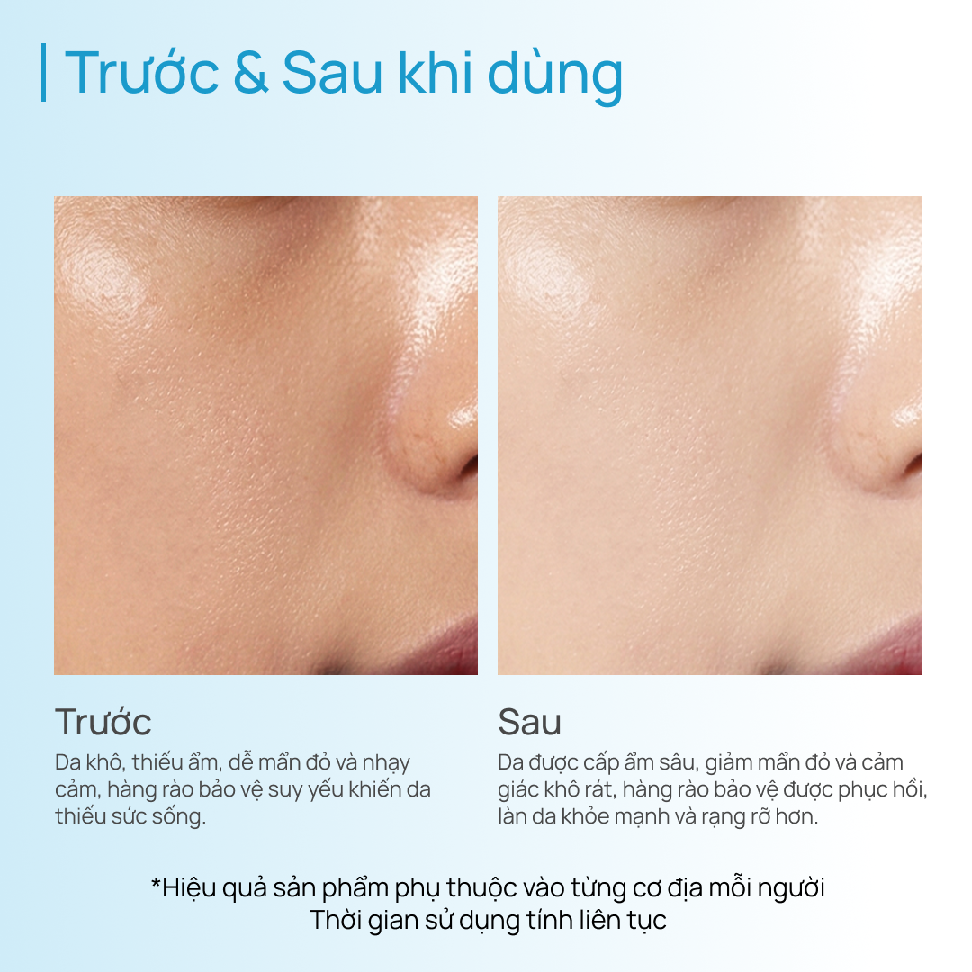 Tinh Chất Phục Hồi, Làm Dịu & Cấp Ẩm CHANDO Soothing Moisturizing 45ml