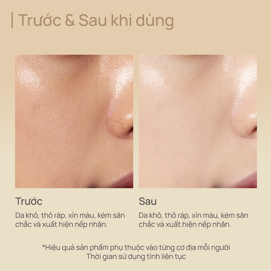 Toner Sửa Chữa Tế Bào, Nâng Cơ & Trẻ Hoá Toàn Diện CHANDO Gold Diamond Ultra Vitalizing Micro-sculpting 200ml