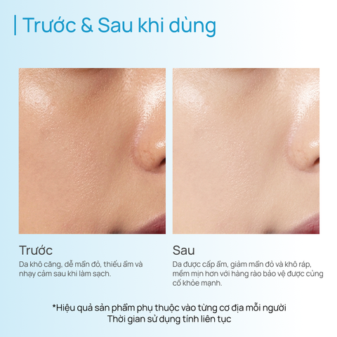 Toner Cân Bằng Da, Làm Dịu & Cấp Ẩm CHANDO Soothing Moisturizing 150ml