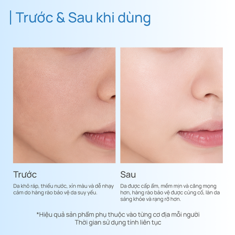 Toner Dưỡng Ẩm & Phục Hồi CHANDO Snowy Region 160ml