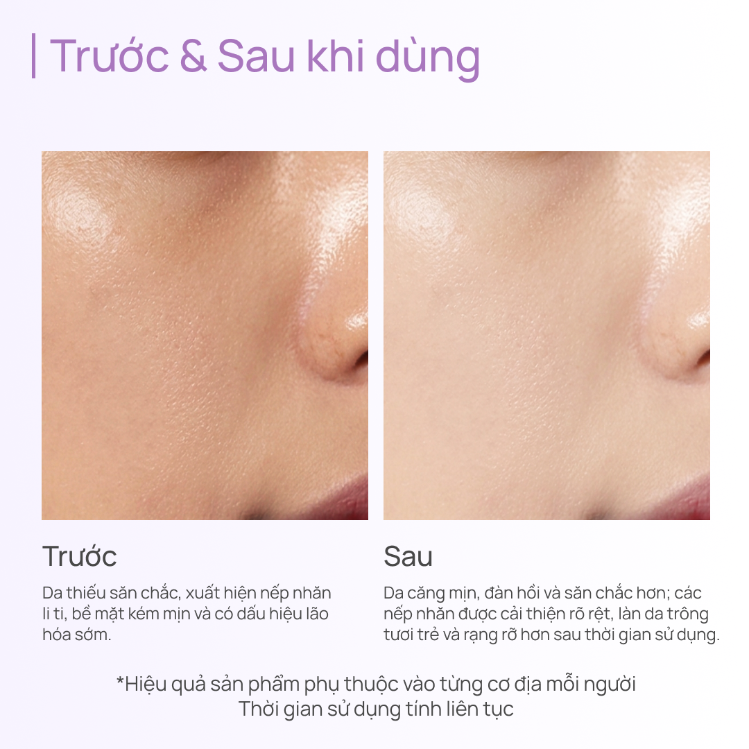 Tinh Chất Chống Lão Hoá, Giảm Xỉn Màu, Mờ Quầng Thâm Time Frozen Aging Resistance Activating Essence 40ml