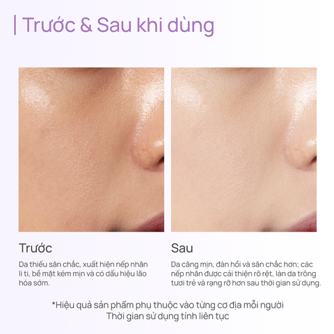 Tinh Chất Chống Lão Hoá, Giảm Xỉn Màu, Mờ Quầng Thâm Time Frozen Aging Resistance Activating Essence 40ml