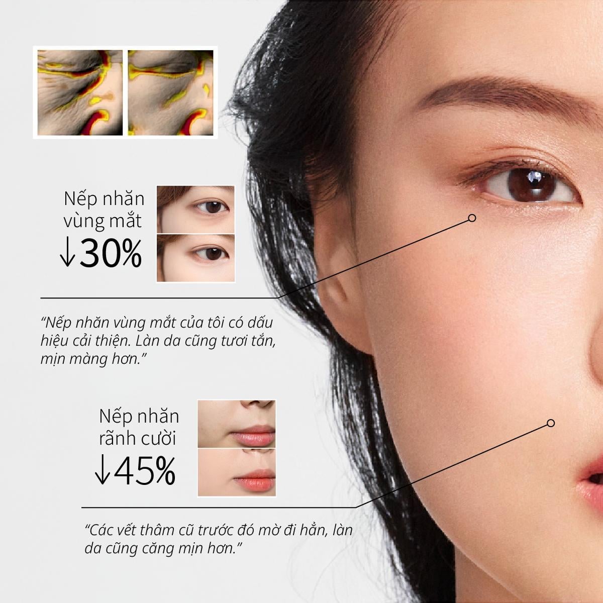 Sữa Dưỡng Giúp Phục Hồi Da Lão Hoá Ngưng Đọng Thời Gian CHANDO Himalaya 120ml Hàng Chính Hãng