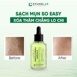 Tinh Chất Serum Dưỡng Da Kyung Lab