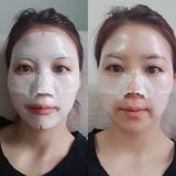 Mặt nạ thạch trẻ hóa da Derm All Matrix Facial Dermal-Care Mask 35g