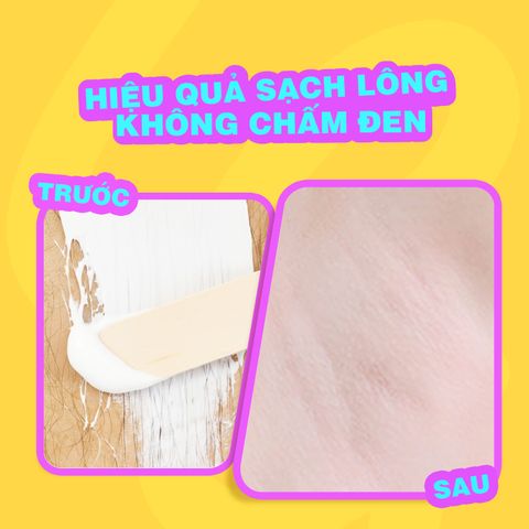 Kem tẩy lông chiết xuất bơ tươi Cléo Hair Removal Cream