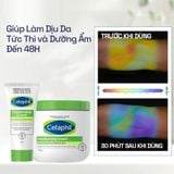 Kem dưỡng ẩm cho da nhạy cảm Cetaphil Moisturizing Cream