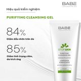 Sữa Rửa Mặt Làm Sạch Dịu Nhẹ Cho Da Dầu Mụn BABE Stop AKN Purifying Cleansing Gel