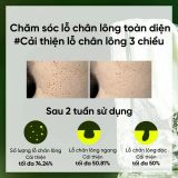 Kem dưỡng da đa năng Beplain Mung Bean Pore Tight-Up Soothing Cream 60ml
