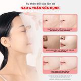 Mặt nạ giấy dưỡng da BNBG Vita Genic Jelly Mask 30ml - Lifting (hộp 10 miếng)