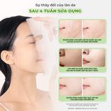 Mặt nạ giấy dưỡng da BNBG Vita Genic Jelly Mask 30ml - Relaxing (hộp 10 miếng)