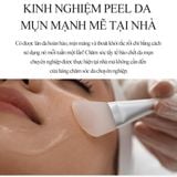 Huyết thanh tẩy da chết hóa học (AHA&BHA) Derma Factory Red Acne Peel