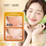 Gel tẩy tế bào chết Dr.Pepti+ Centella Turnover Soft Peeling Gel 30ml
