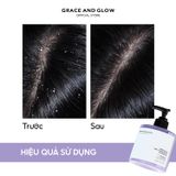 Dầu gội giảm gàu ngứa Grace And Glow Amethyst Anti Dandruff Sampoo 400ml