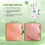 Serum hỗ trợ dịu da KEYSHU CICAMAX REFINE