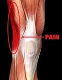  Băng Giảm Hội Chứng Dải Chậu Chày - Pro-Tec IT Band Compression Wrap 