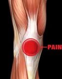  Bó Gối Chống Chấn Thương Thể Thao Pro-Tec X-Trac Knee Support 