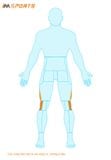  Băng Giảm Hội Chứng Dải Chậu Chày - Pro-Tec IT Band Compression Wrap 