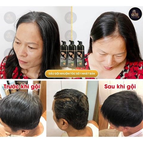 Dầu gội phủ bạc Sin Hair, dầu gội nhân sâm Nhật Bản Mẫu Mới  500ml tặng nón trùm ủ dày