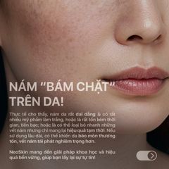 Kem Giảm Nám Da Chuẩn Khoa Học Triple Action T.A.K Hiệu Quả Chỉ Sau 7 Ngày NEOTHERA MELASMA CREAM 30ml (Chai)