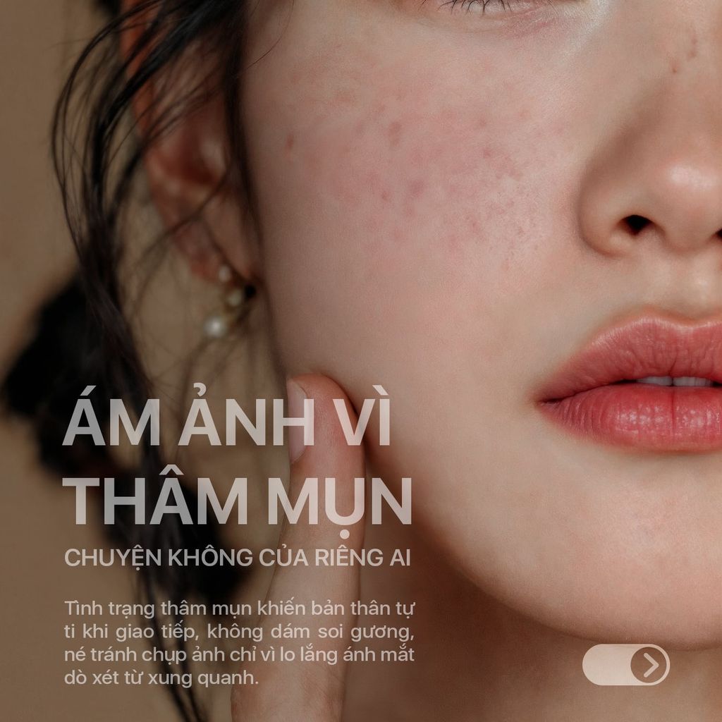 Gel Nghệ Nano NeoCurma – Giảm Mụn, Mờ Thâm Sẹo (20g)