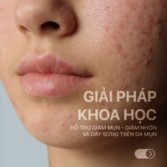 Combo 2 tuýp Neothera Acnes Gel (15ml x2)