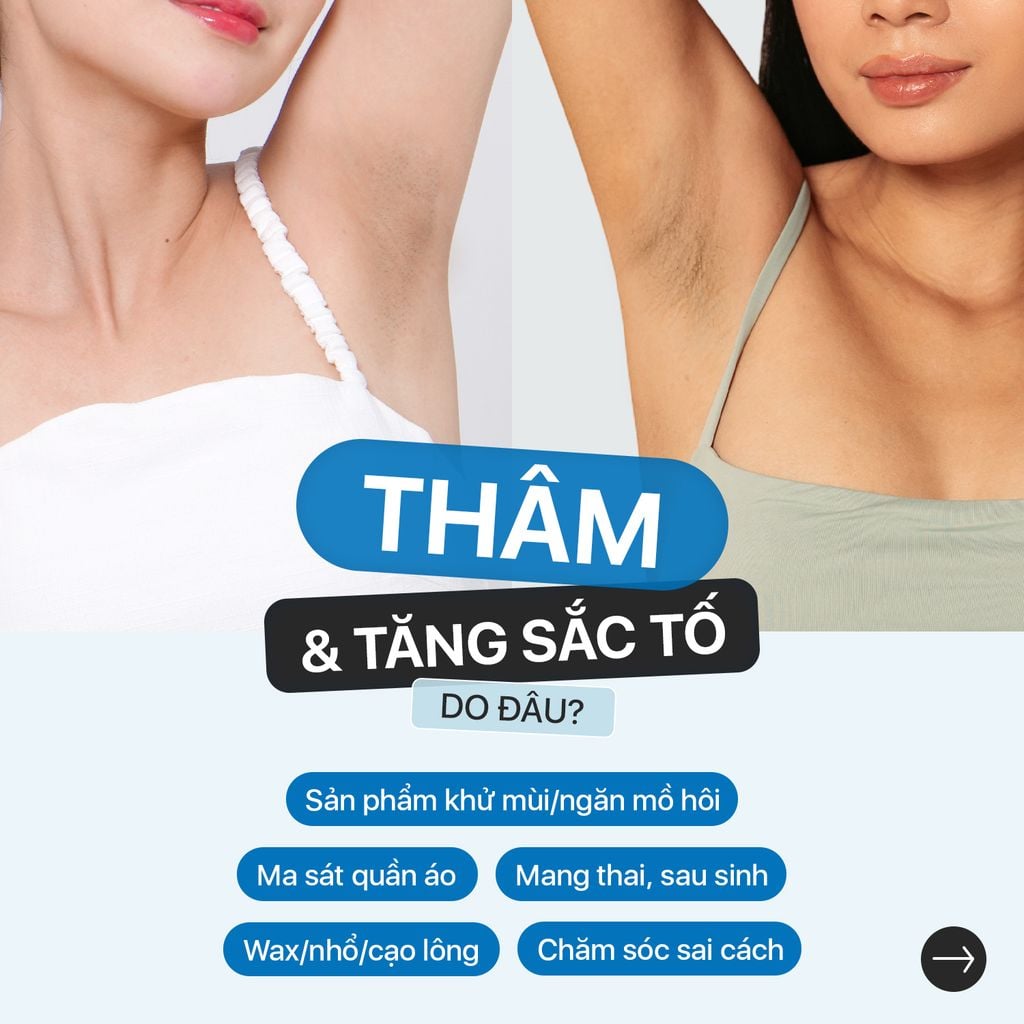 Combo 2 tuýp Neothera Armpit Cream - Dưỡng Sáng Giảm Thâm Nách (35g x2)