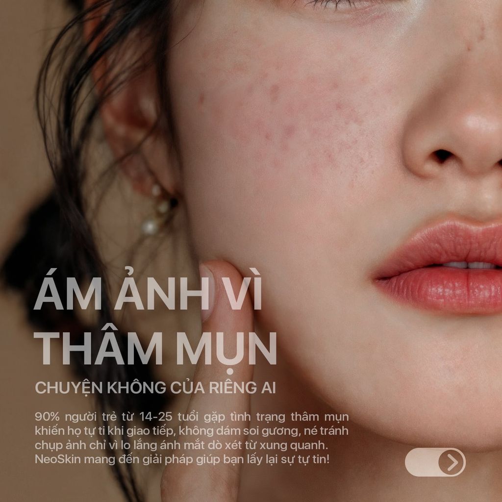 Sữa Rửa Mặt Nghệ NeoCleanser – Sạch Da, Kiểm Soát Nhờn, Ngừa Mụn Thâm (86g)