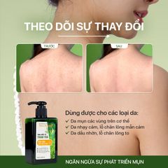 Sữa tắm mụn lưng, giảm nang lông, ngừa thâm mụn chiết xuất Tràm trà úc và trầu không NEOSKIN 250ml