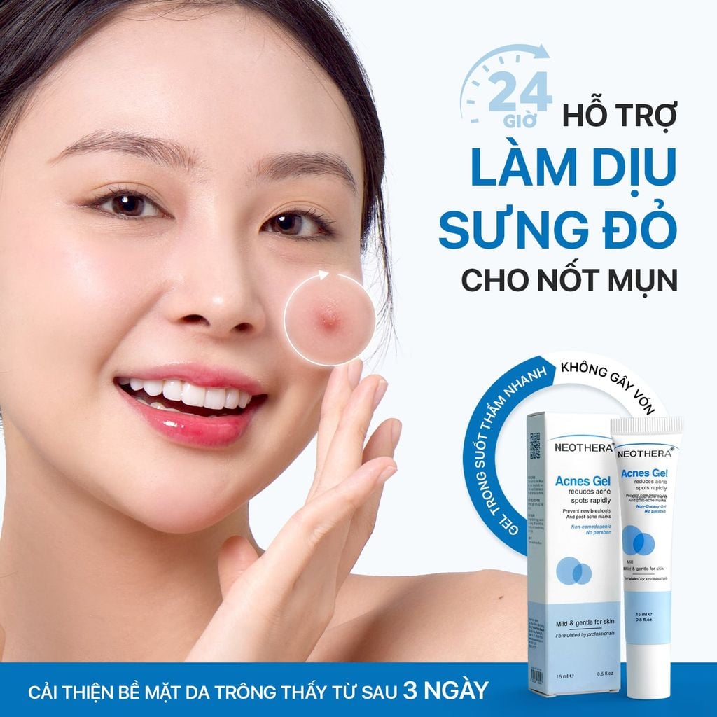 Gel Giảm Mụn Thâm, Sẹo Mụn & Cải Thiện Da Dầu, Mụn Neothera Acnes Gel (15ml)