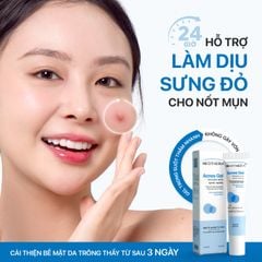 Gel Giảm Mụn Thâm, Sẹo Mụn & Cải Thiện Da Dầu, Mụn Neothera Acnes Gel (15ml)